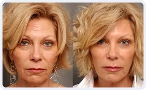 Ageless