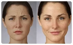 Ageless