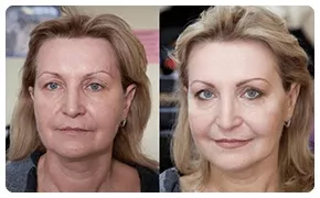 Ageless