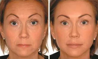 Ageless
