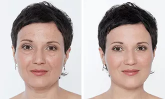 Ageless
